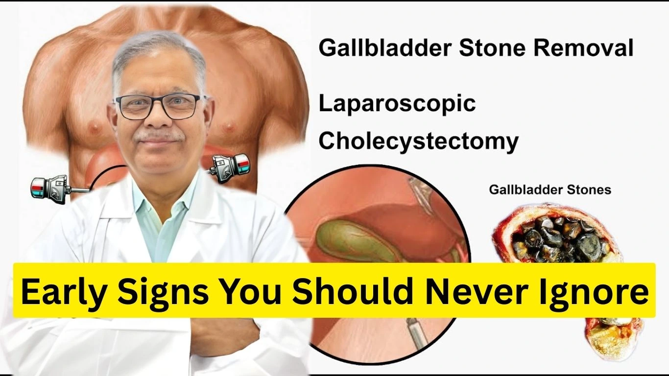 Gallbladder Stone